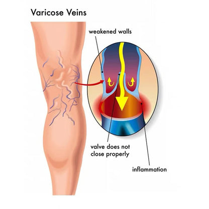 VasoRelief Infrared Lamp